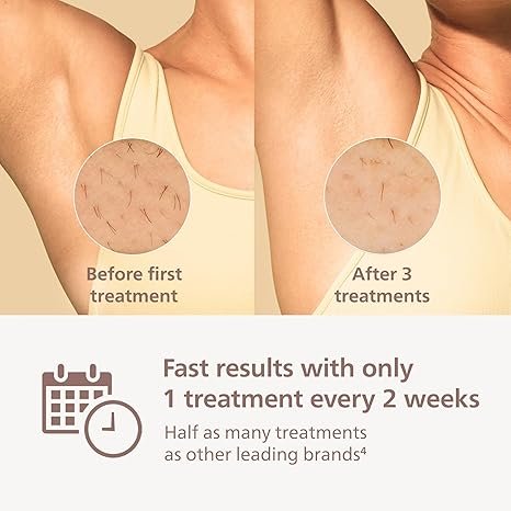 Philips Lumea 9000 Series IPL Hair Removal Device, Permanent Laser Hair Reduction for Women & Men, Easy & Comfortable Use at Home, SenseIQ, 4 Attachments for Body, Face, Bikini & Underarms, BRI984/03 - Image 4